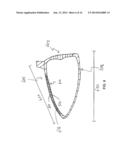 GOLF CLUB HEAD WITH STIFFENING AND SOUND TUNING COMPOSITE MEMBER diagram and image