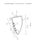 GOLF CLUB HEAD WITH STIFFENING AND SOUND TUNING COMPOSITE MEMBER diagram and image