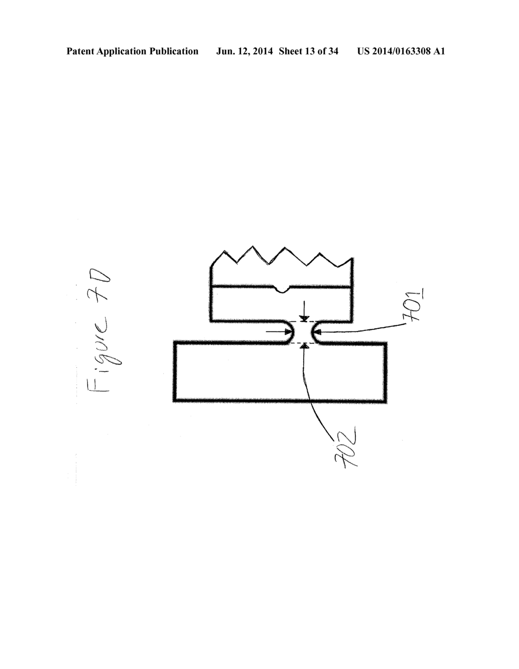 ELECTROMECHANICAL TRANSDUCER WITH MECHANICAL ADVANTAGE - diagram, schematic, and image 14