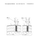 LAPAROSCOPIC CANNULA WITH SUTURING CAPABILITY diagram and image