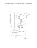 Portable Tonometer diagram and image