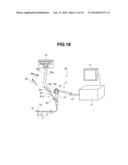 TUMOR TISSUE REDUCTIVE PROCEDURE UNDER ULTRASOUND OBSERVATION diagram and image