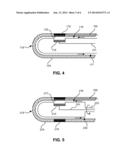 ABLATION APPARATUS diagram and image