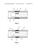 ABLATION APPARATUS diagram and image