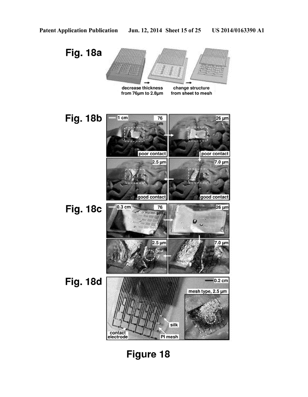 Implantable Biomedical Devices on Bioresorbable Substrates - diagram, schematic, and image 16