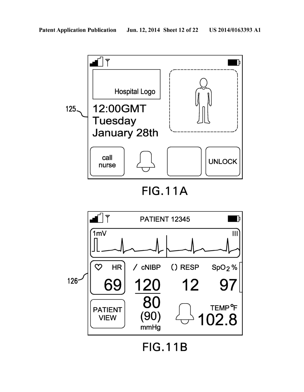 ALARM SYSTEM THAT PROCESSES BOTH MOTION AND VITAL SIGNS USING SPECIFIC     HEURISTIC RULES AND THRESHOLDS - diagram, schematic, and image 13