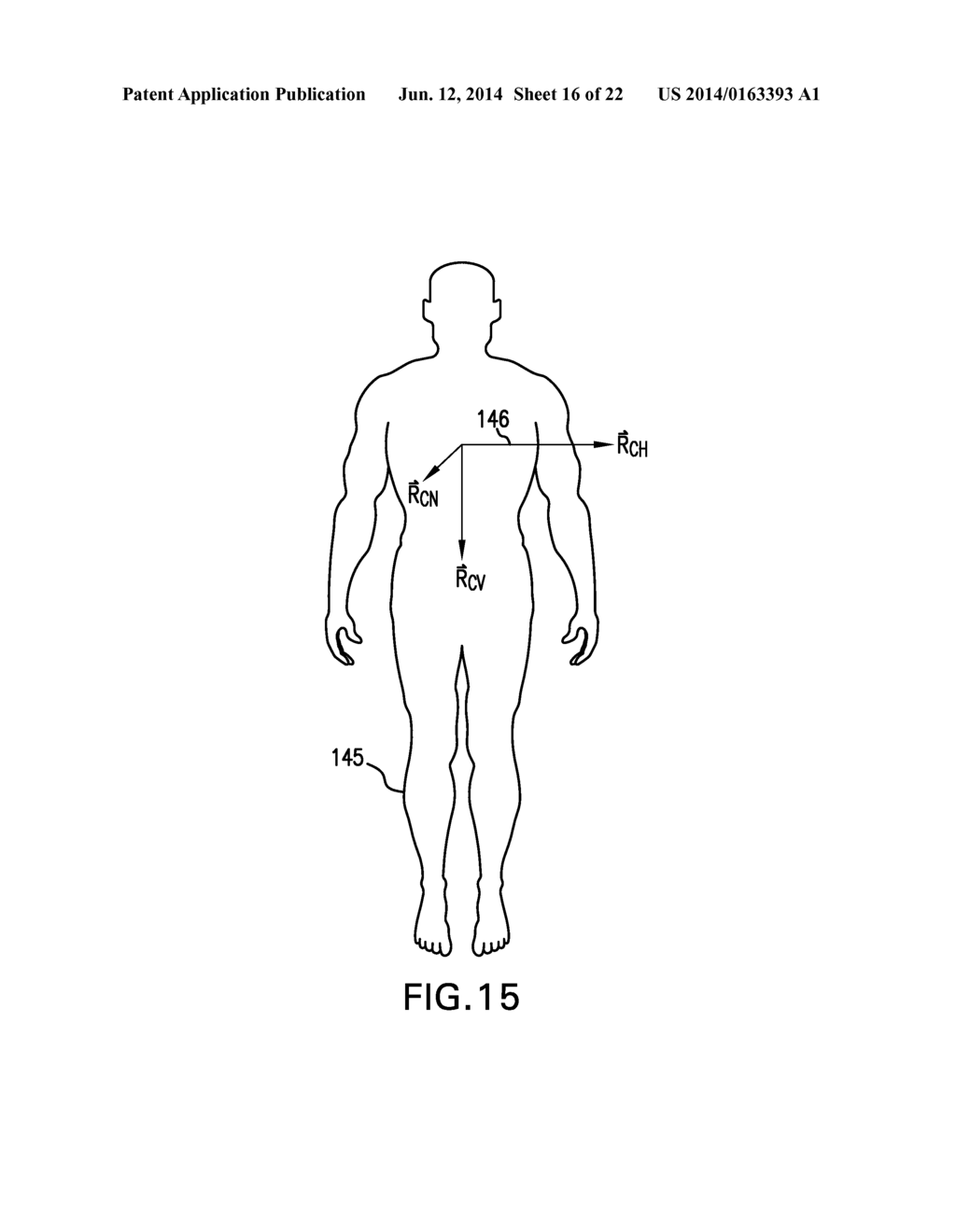 ALARM SYSTEM THAT PROCESSES BOTH MOTION AND VITAL SIGNS USING SPECIFIC     HEURISTIC RULES AND THRESHOLDS - diagram, schematic, and image 17