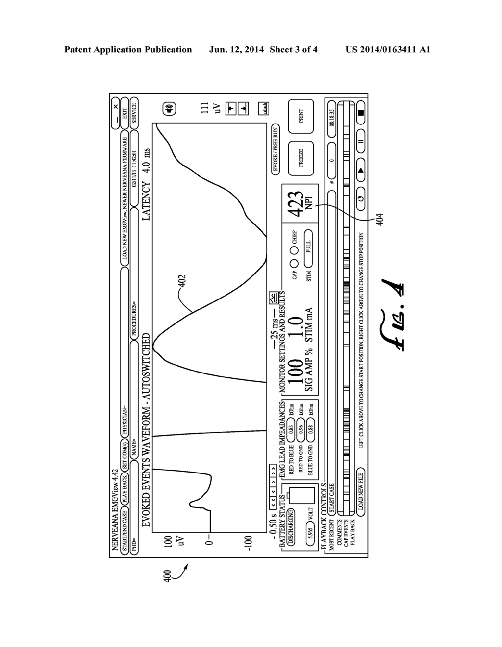 METHOD OF DETECTING REVERSIBLE NERVE INJURY - diagram, schematic, and image 04