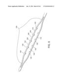 BIOPSY NEEDLE WITH A LATERALLY EXPANDABLE DISTAL PORTION diagram and image