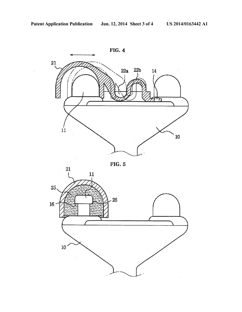 Variable Acupressure Ball for Massaging Apparatus - diagram, schematic, and image 04