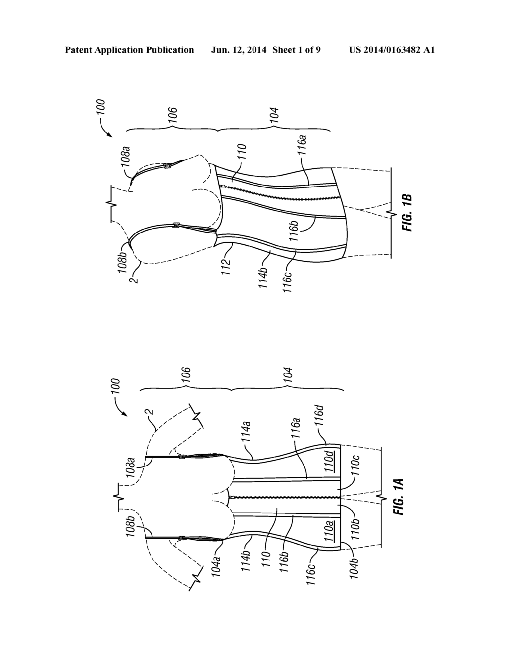 FIGURE MOULDING AND WEIGHT LOSS AID SYSTEMS AND METHODS - diagram, schematic, and image 02