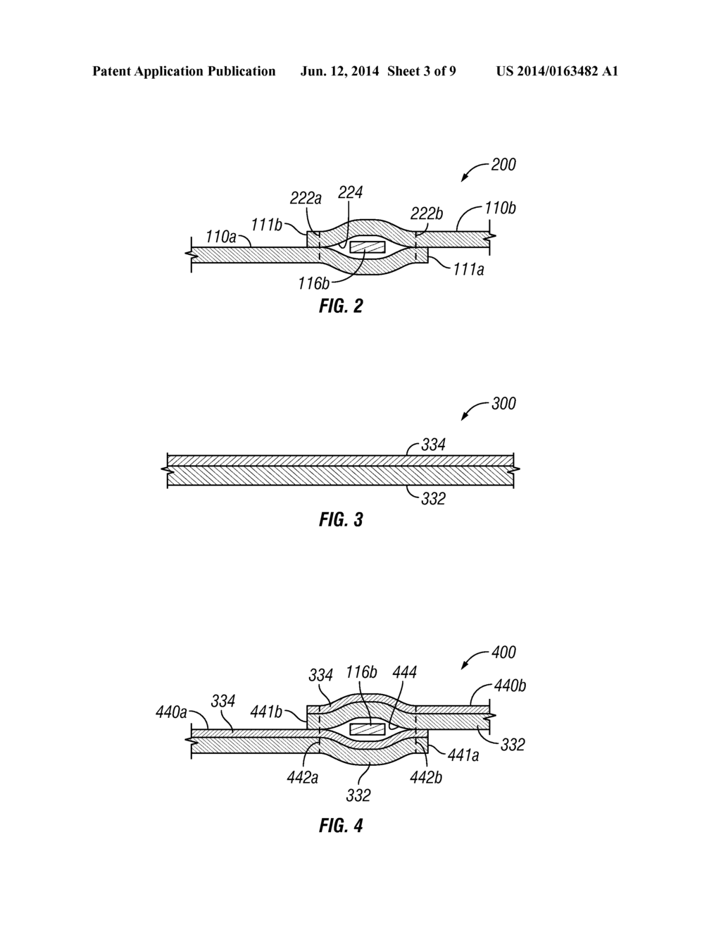 FIGURE MOULDING AND WEIGHT LOSS AID SYSTEMS AND METHODS - diagram, schematic, and image 04