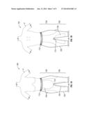 FIGURE MOULDING AND WEIGHT LOSS AID SYSTEMS AND METHODS diagram and image