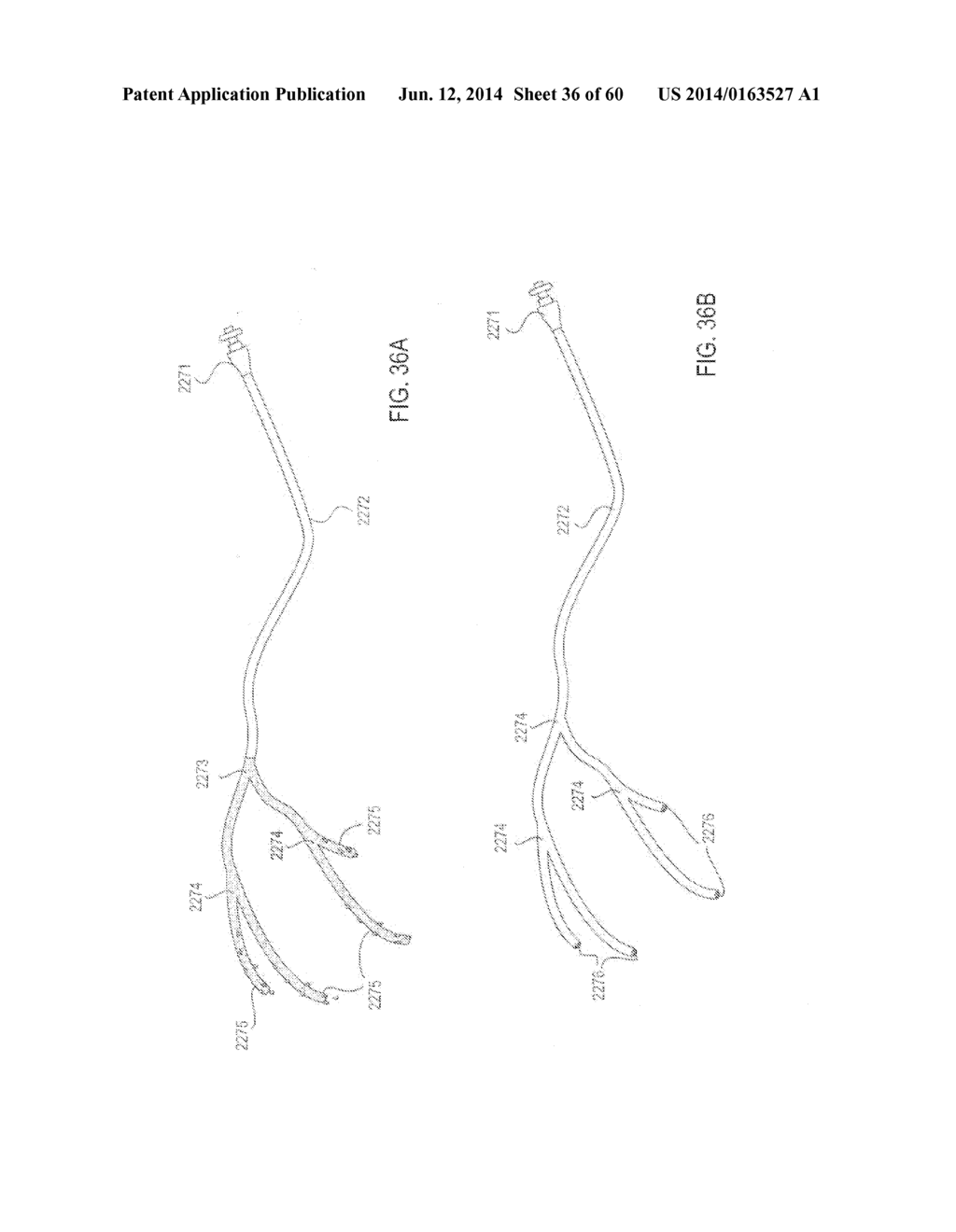 SYSTEM FOR REDUCING LOCAL DISCOMFORT - diagram, schematic, and image 37