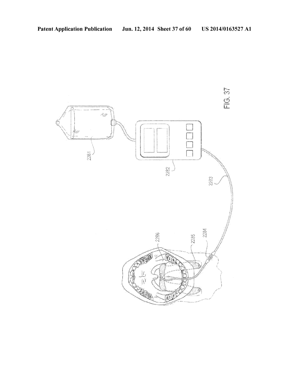 SYSTEM FOR REDUCING LOCAL DISCOMFORT - diagram, schematic, and image 38