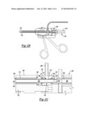 ASPIRATING CAUTERY FORCEPS diagram and image