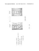 DETERMINING AND PLACING SPINAL IMPLANTS OR PROSTHESES diagram and image