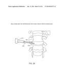 DETERMINING AND PLACING SPINAL IMPLANTS OR PROSTHESES diagram and image