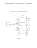 DETERMINING AND PLACING SPINAL IMPLANTS OR PROSTHESES diagram and image