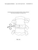 DETERMINING AND PLACING SPINAL IMPLANTS OR PROSTHESES diagram and image