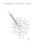 DETERMINING AND PLACING SPINAL IMPLANTS OR PROSTHESES diagram and image