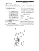 MINIMALLY INVASIVE IMPLANTABLE NEUROSTIMULATION SYSTEM diagram and image