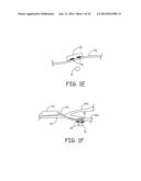 MINIMALLY INVASIVE IMPLANTABLE NEUROSTIMULATION SYSTEM diagram and image