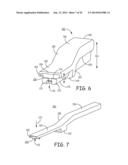 MINIMALLY INVASIVE IMPLANTABLE NEUROSTIMULATION SYSTEM diagram and image