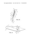 MINIMALLY INVASIVE IMPLANTABLE NEUROSTIMULATION SYSTEM diagram and image