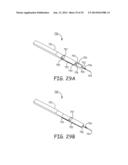 MINIMALLY INVASIVE IMPLANTABLE NEUROSTIMULATION SYSTEM diagram and image