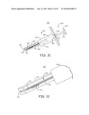 MINIMALLY INVASIVE IMPLANTABLE NEUROSTIMULATION SYSTEM diagram and image