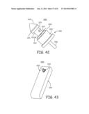 MINIMALLY INVASIVE IMPLANTABLE NEUROSTIMULATION SYSTEM diagram and image