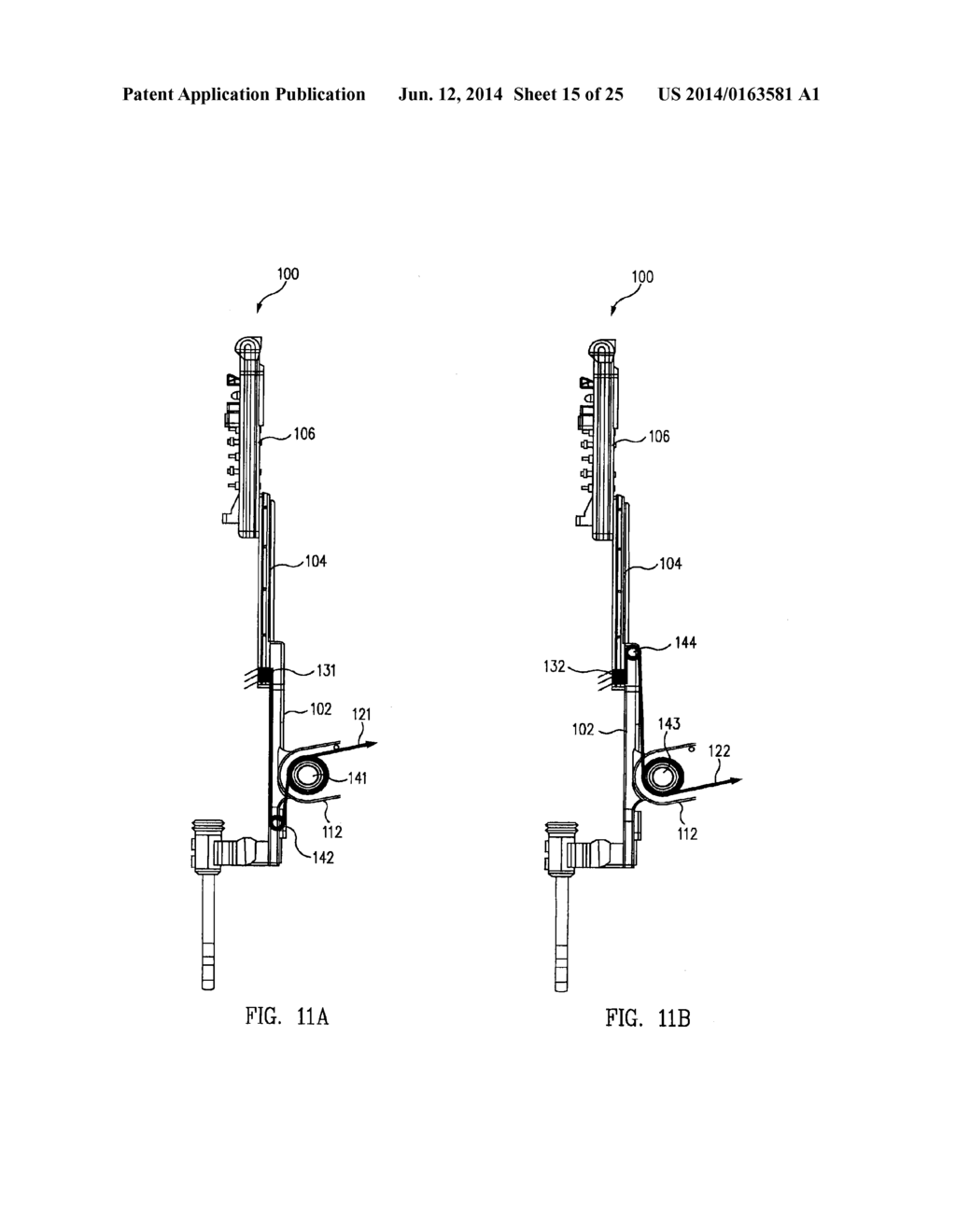 Telescoping Insertion Axis of a Robotic Surgical System - diagram, schematic, and image 16