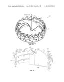 CONCENTRIC CUTTING DEVICES FOR USE IN MINIMALLY INVASIVE MEDICAL     PROCEDURES diagram and image