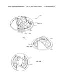 CONCENTRIC CUTTING DEVICES FOR USE IN MINIMALLY INVASIVE MEDICAL     PROCEDURES diagram and image