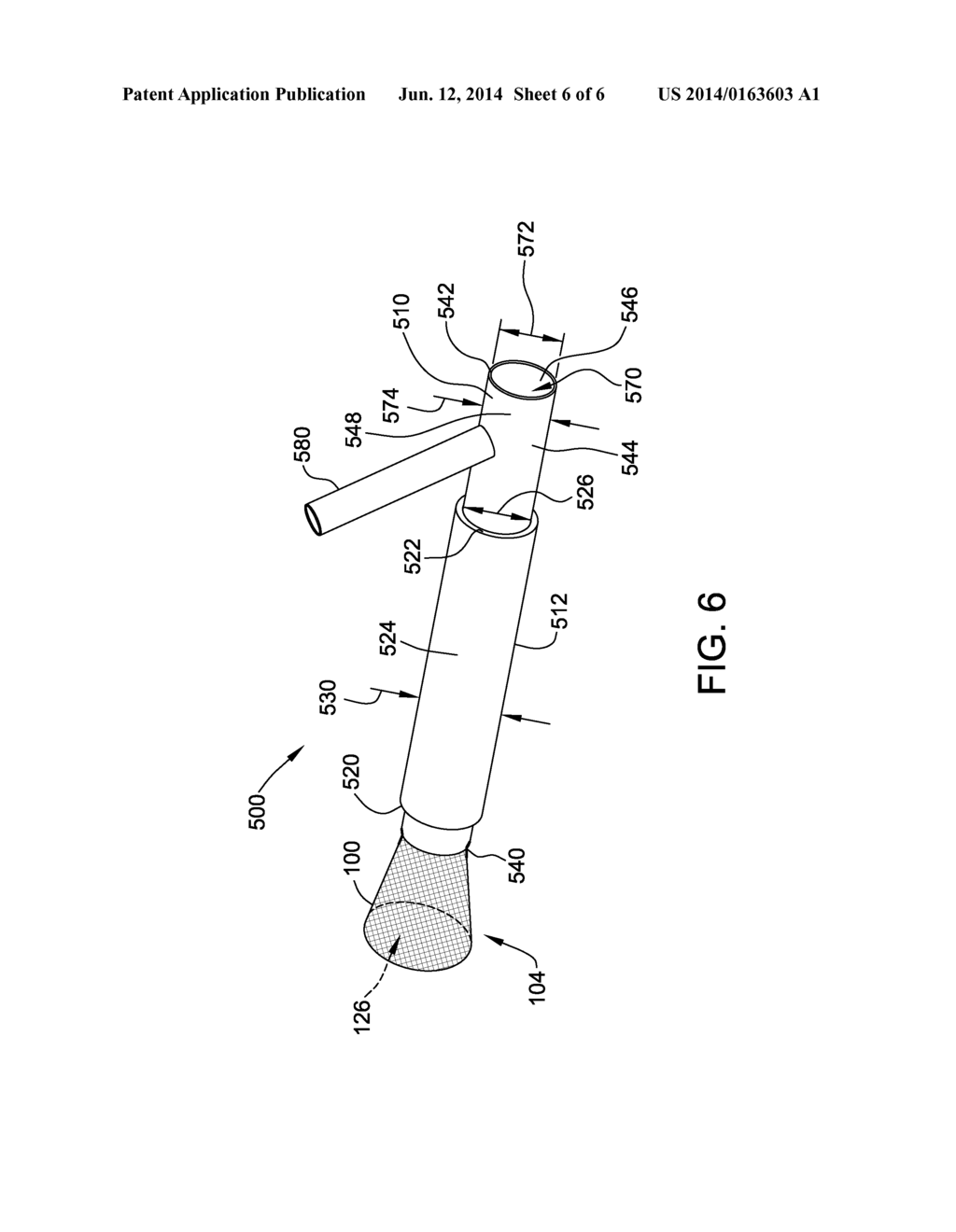 METHODS AND APPARATUS FOR CAPTURING EMBOLIC DEBRIS DURING ENDOVASCULAR     PROCEDURES - diagram, schematic, and image 07