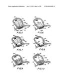 FILTER APPARATUS FOR OSTIUM OF LEFT ATRIAL APPENDAGE diagram and image