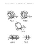 FILTER APPARATUS FOR OSTIUM OF LEFT ATRIAL APPENDAGE diagram and image