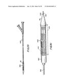 FILTER APPARATUS FOR OSTIUM OF LEFT ATRIAL APPENDAGE diagram and image