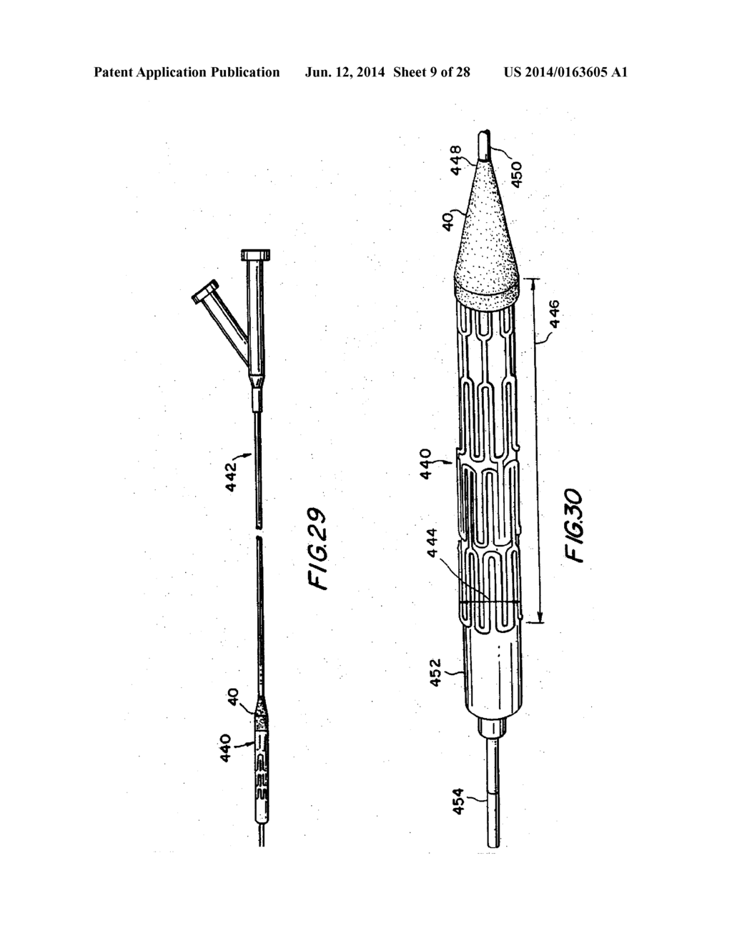 FILTER APPARATUS FOR OSTIUM OF LEFT ATRIAL APPENDAGE - diagram, schematic, and image 10