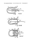 FILTER APPARATUS FOR OSTIUM OF LEFT ATRIAL APPENDAGE diagram and image