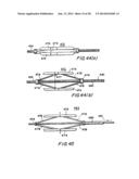 FILTER APPARATUS FOR OSTIUM OF LEFT ATRIAL APPENDAGE diagram and image