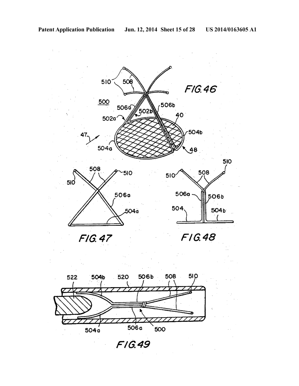 FILTER APPARATUS FOR OSTIUM OF LEFT ATRIAL APPENDAGE - diagram, schematic, and image 16