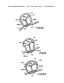 FILTER APPARATUS FOR OSTIUM OF LEFT ATRIAL APPENDAGE diagram and image