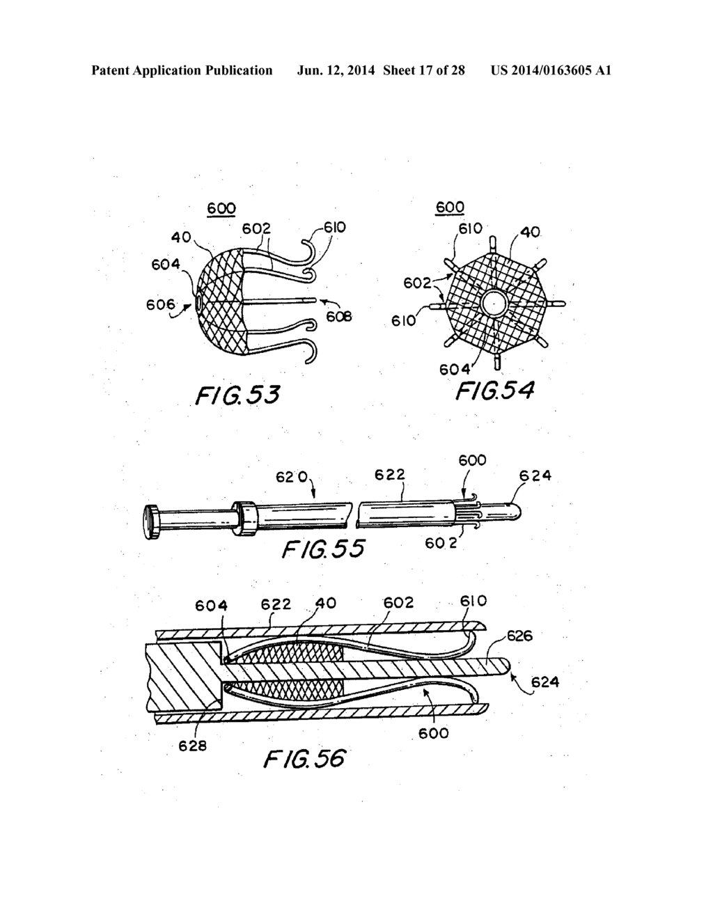 FILTER APPARATUS FOR OSTIUM OF LEFT ATRIAL APPENDAGE - diagram, schematic, and image 18