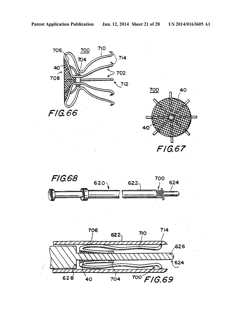 FILTER APPARATUS FOR OSTIUM OF LEFT ATRIAL APPENDAGE - diagram, schematic, and image 22