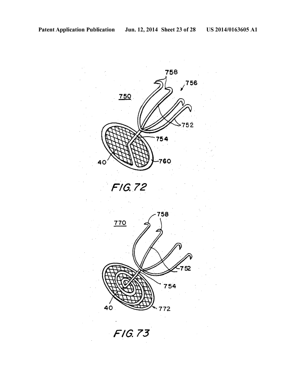 FILTER APPARATUS FOR OSTIUM OF LEFT ATRIAL APPENDAGE - diagram, schematic, and image 24