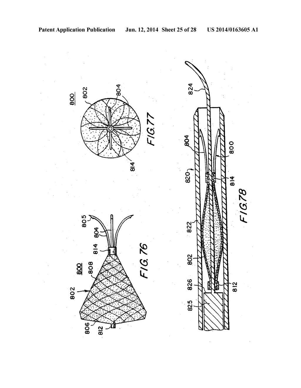 FILTER APPARATUS FOR OSTIUM OF LEFT ATRIAL APPENDAGE - diagram, schematic, and image 26