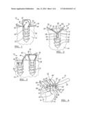 Method And Apparatus For Soft Tissue Fixation diagram and image