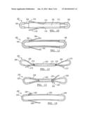 Method And Apparatus For Soft Tissue Fixation diagram and image